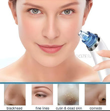 Detachable Blackhead Removing Tool - Durable & Easy to Clean